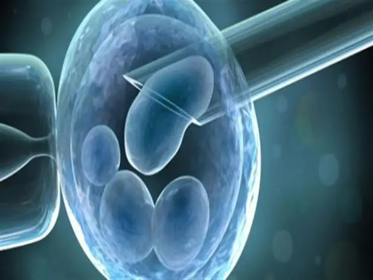 أطفال الأنابيب حرام ام حلال